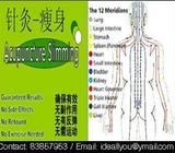 Acupuncture Slimming